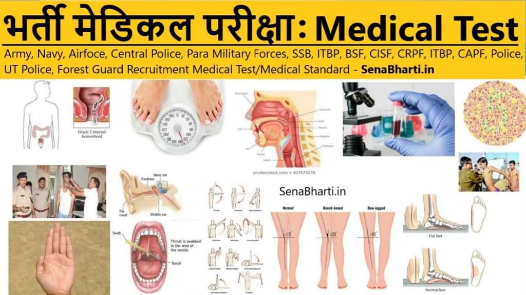 Bharti Medical Test Police Recruitment Medical Test, State Police Medical Test