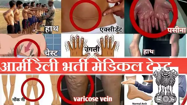 Indian Army Medical Test