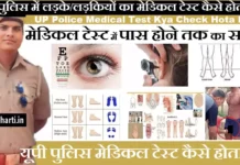 यूपी पुलिस में लड़के/लड़कियों का मेडिकल टेस्ट कैसे होता है? UP Police Medical Test 2025 UP Police Medical Test 2024 UP Police Constable Medical Test 2024
