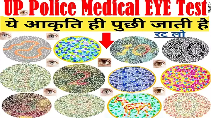 यूपी पुलिस में लड़के/लड़कियों का मेडिकल टेस्ट कैसे होता है? UP Police Medical Test 2026 1 UP Police medical EYE test UP Police colour blindness UP Police colour vision